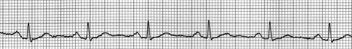 Cardiograma